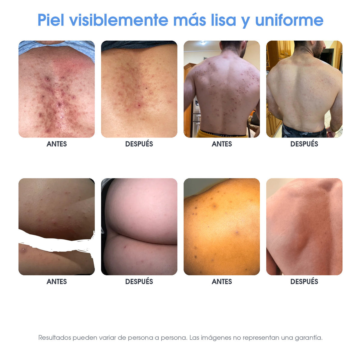 Liso. Sérum Corporal con Ácido Mandélico